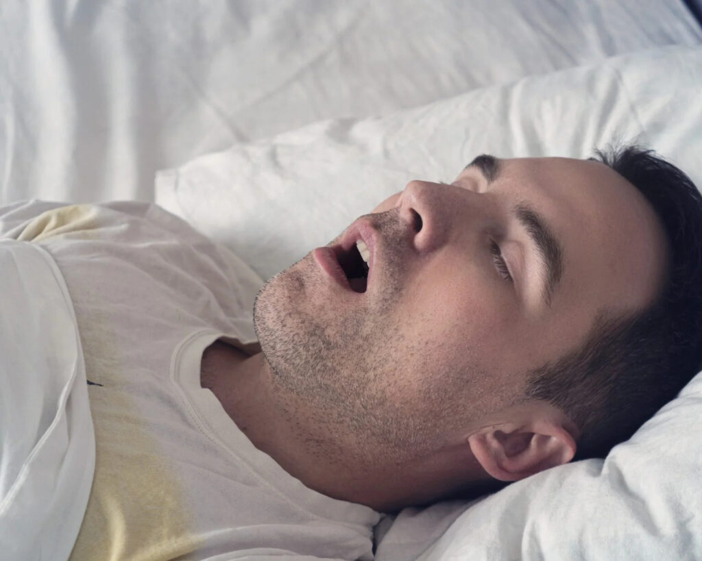 Homem roncando precisando de tratamento com CPAP